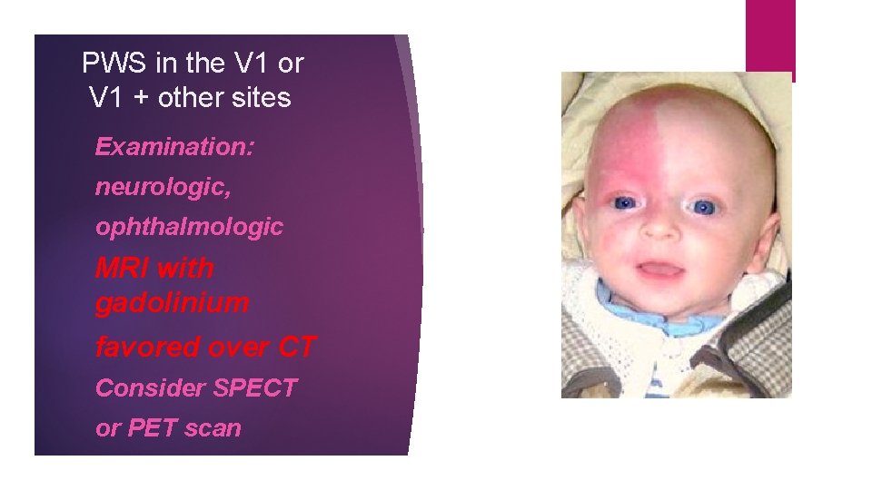 PWS in the V 1 or V 1 + other sites Examination: neurologic, ophthalmologic
