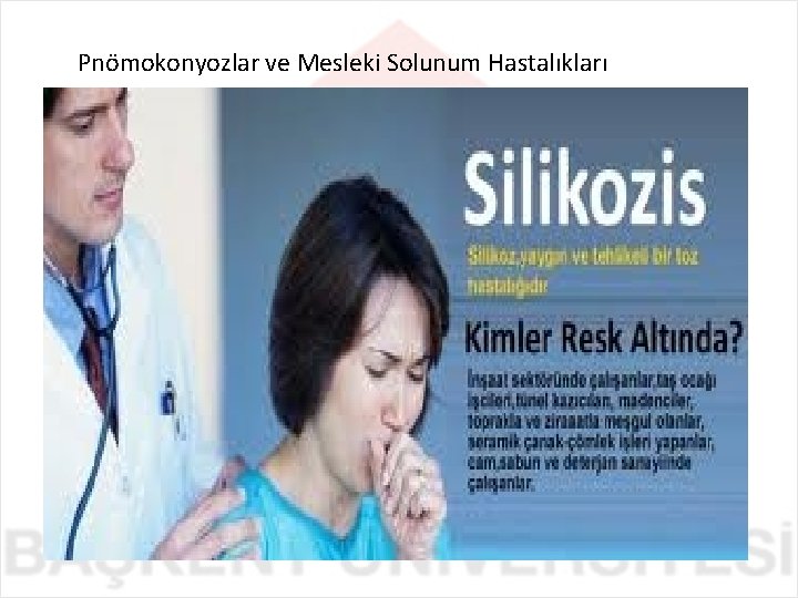 Pnömokonyozlar ve Mesleki Solunum Hastalıkları 