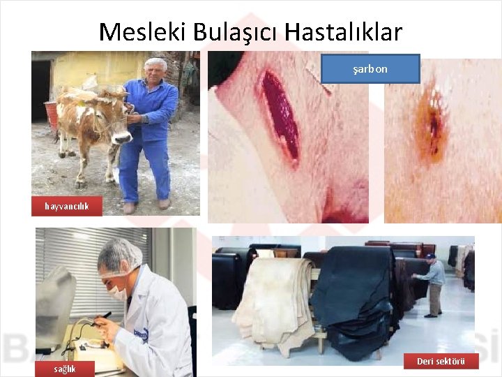Mesleki Bulaşıcı Hastalıklar şarbon hayvancılık sağlık Deri sektörü 