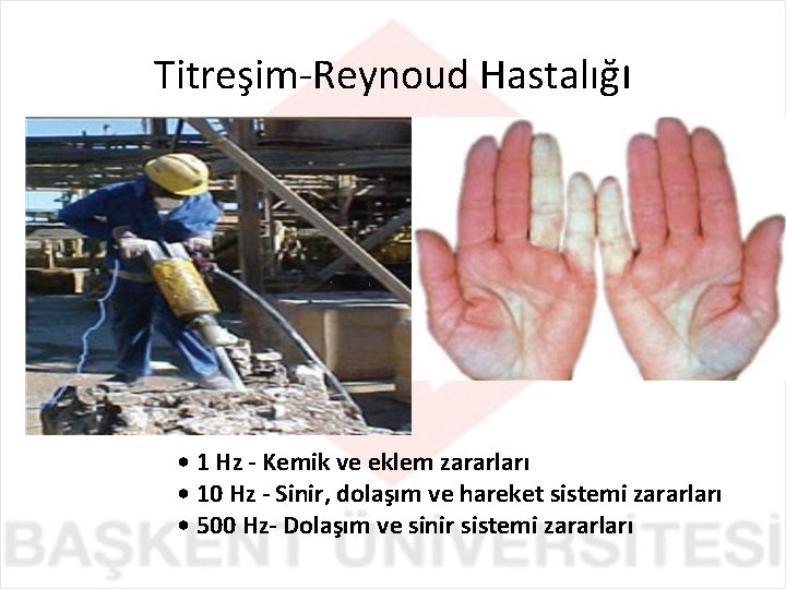 Titreşim-Reynoud Hastalığı • 1 Hz - Kemik ve eklem zararları • 10 Hz -