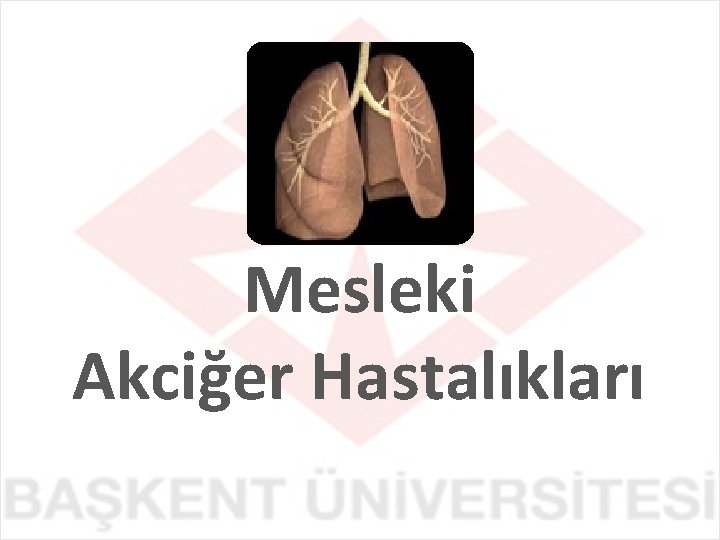 Mesleki Akciğer Hastalıkları 