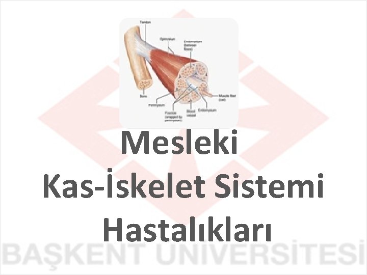 Mesleki Kas-İskelet Sistemi Hastalıkları 