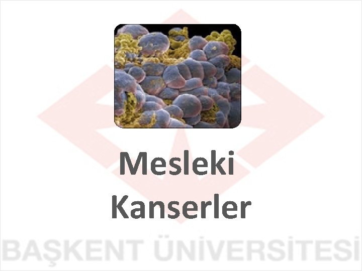 Mesleki Kanserler 