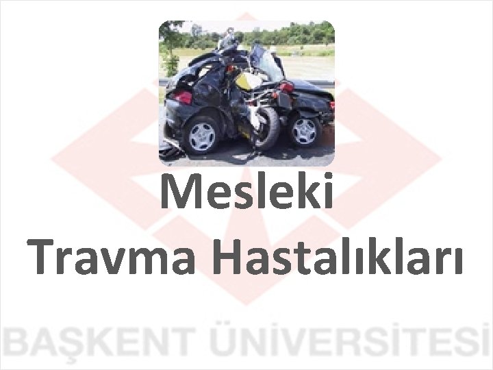 Mesleki Travma Hastalıkları 