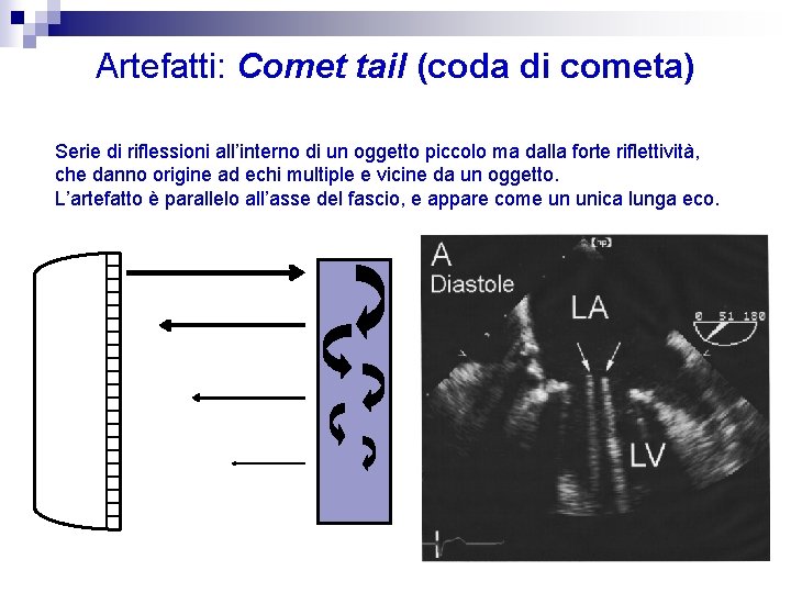 Artefatti: Comet tail (coda di cometa) Serie di riflessioni all’interno di un oggetto piccolo