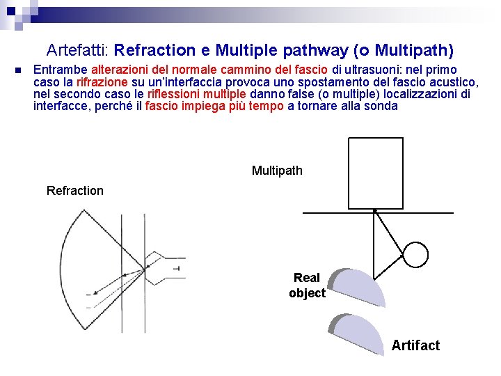 Artefatti: Refraction e Multiple pathway (o Multipath) n Entrambe alterazioni del normale cammino del