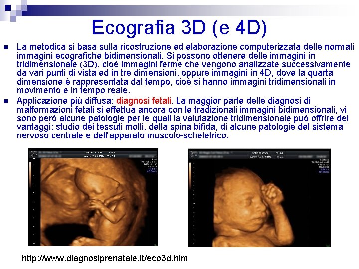 Ecografia 3 D (e 4 D) n n La metodica si basa sulla ricostruzione