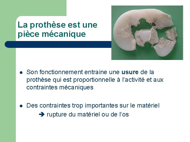 La prothèse est une pièce mécanique l Son fonctionnement entraine usure de la prothèse La prothèse est une pièce mécanique l Son fonctionnement entraine usure de la prothèse