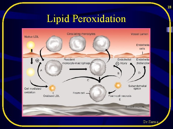 18 Lipid Peroxidation Dr. Sarma 18 Lipid Peroxidation Dr. Sarma