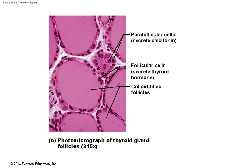 Figure 17. 5 b The thyroid gland. Parafollicular cells (secrete calcitonin) Follicular cells (secrete