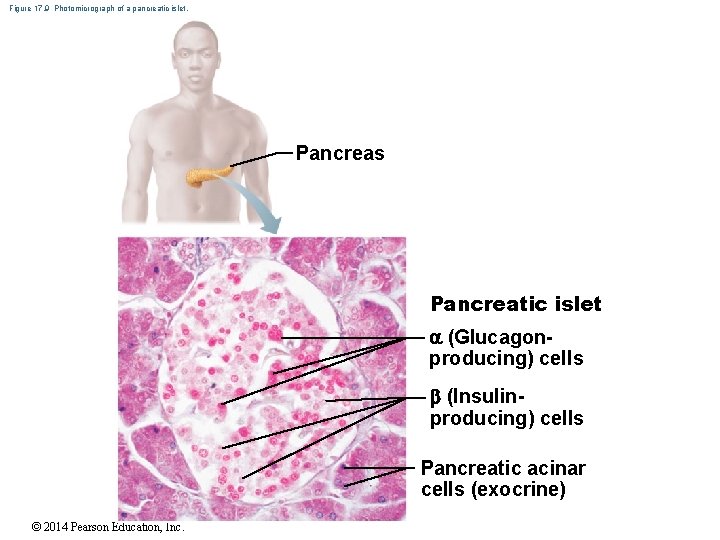 Figure 17. 9 Photomicrograph of a pancreatic islet. Pancreas Pancreatic islet (Glucagonproducing) cells (Insulinproducing)