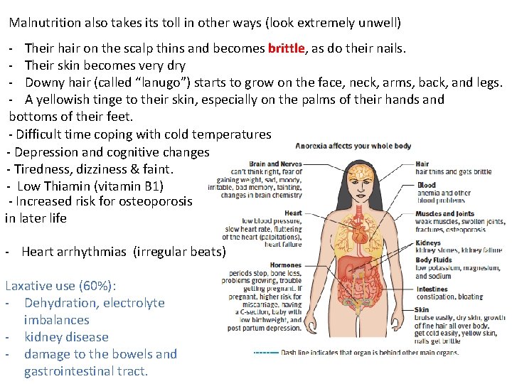 Malnutrition also takes its toll in other ways (look extremely unwell) - Their hair Malnutrition also takes its toll in other ways (look extremely unwell) - Their hair