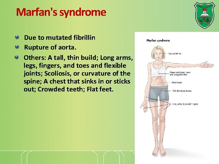 Marfan's syndrome Due to mutated fibrillin Rupture of aorta. Others: A tall, thin build;