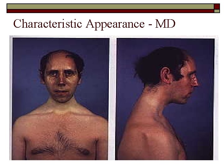 Characteristic Appearance - MD 