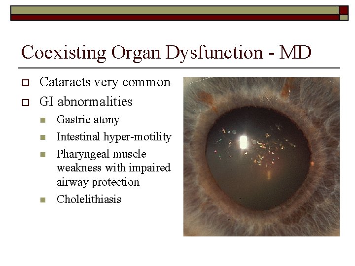 Coexisting Organ Dysfunction - MD o o Cataracts very common GI abnormalities n n