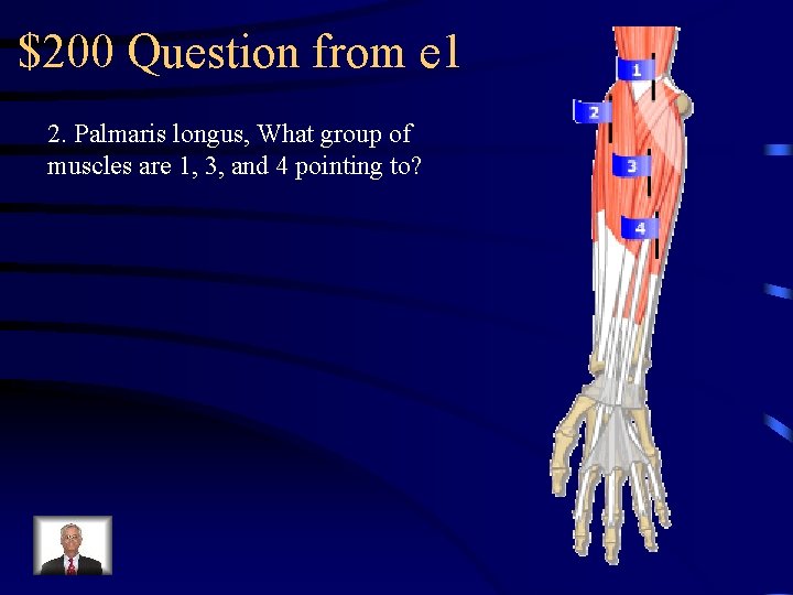 $200 Question from e 1 2. Palmaris longus, What group of muscles are 1,