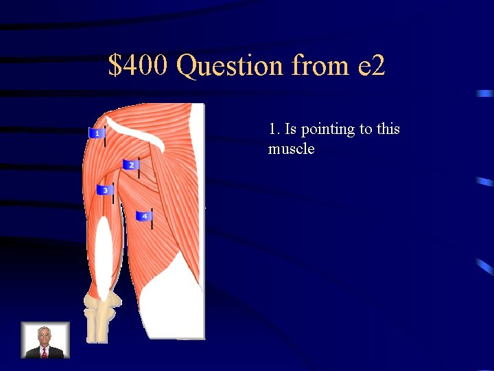 $400 Question from e 2 1. Is pointing to this muscle 