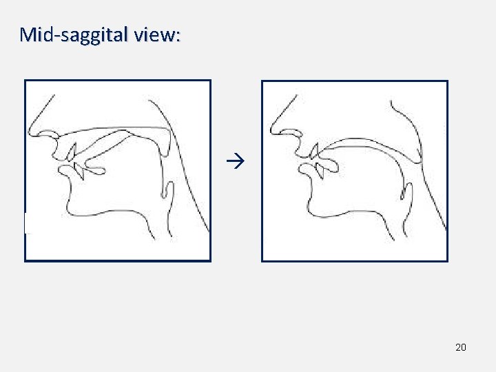 Mid-saggital view: 20 