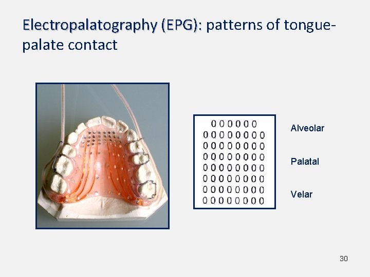 Electropalatography (EPG): patterns of tonguepalate contact Alveolar Palatal Velar 30 