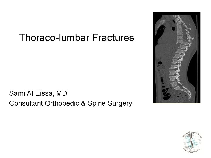 Thoraco-lumbar Fractures Sami Al Eissa, MD Consultant Orthopedic & Spine Surgery 