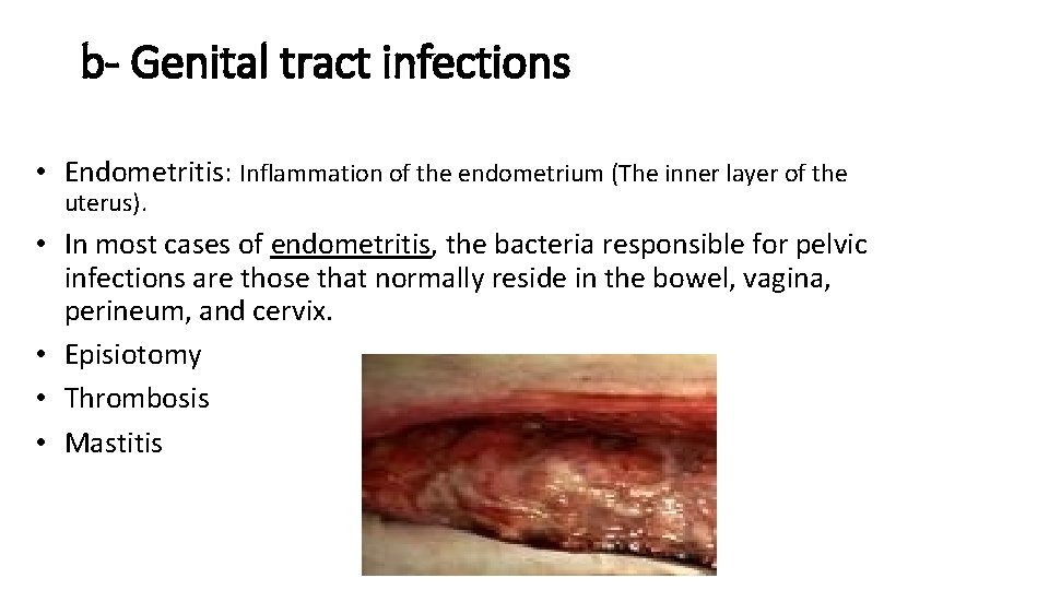 b- Genital tract infections • Endometritis: Inflammation of the endometrium (The inner layer of