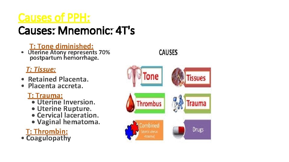 Causes of PPH: Causes: Mnemonic: 4 T's T: Tone diminished: • Uterine Atony represents