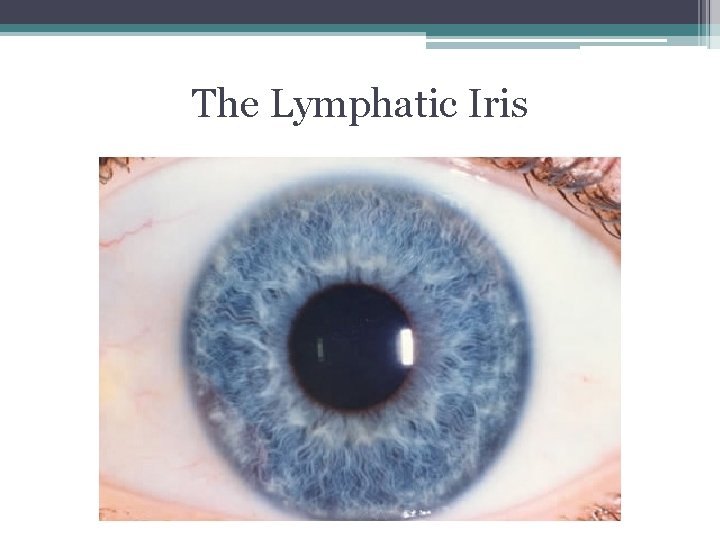 The Lymphatic Iris The Lymphatic Iris