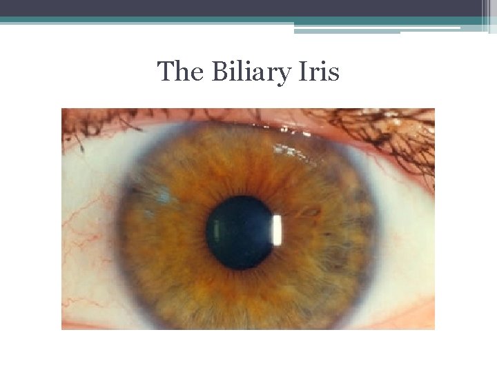 The Biliary Iris The Biliary Iris