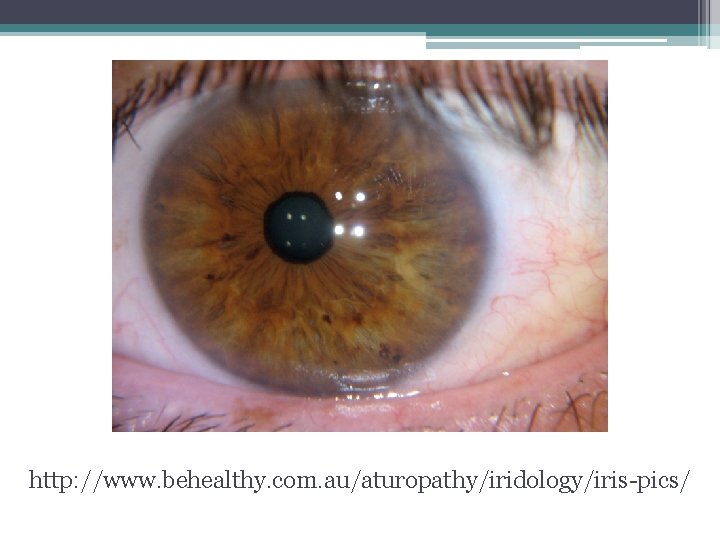 http: //www. behealthy. com. au/aturopathy/iridology/iris-pics/ http: //www. behealthy. com. au/aturopathy/iridology/iris-pics/