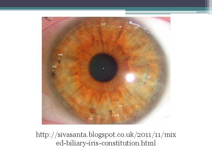 http: //sivasanta. blogspot. co. uk/2011/11/mix ed-biliary-iris-constitution. html http: //sivasanta. blogspot. co. uk/2011/11/mix ed-biliary-iris-constitution. html
