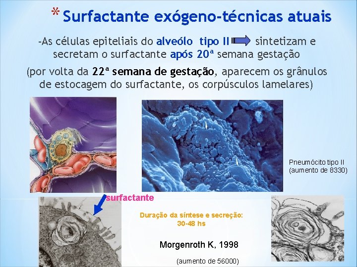 * Surfactante exógeno-técnicas atuais -As células epiteliais do alveólo tipo II sintetizam e secretam * Surfactante exógeno-técnicas atuais -As células epiteliais do alveólo tipo II sintetizam e secretam