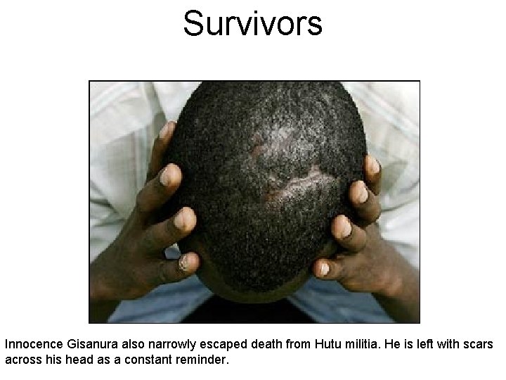 Survivors Innocence Gisanura also narrowly escaped death from Hutu militia. He is left with