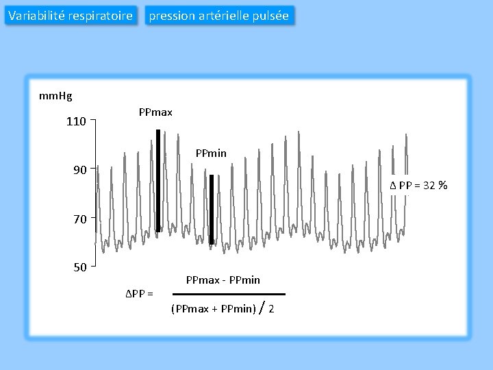 Variabilité respiratoire pression artérielle pulsée mm. Hg 110 PPmax PPmin 90 Δ PP =