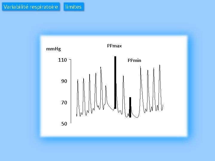 Variabilité respiratoire limites PPmax mm. Hg 110 90 70 50 PPmin 