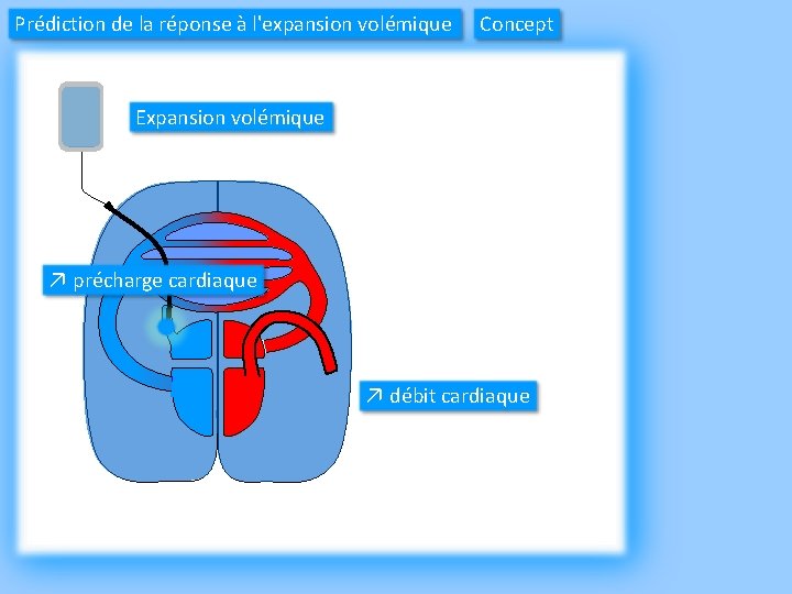Prédiction de la réponse à l'expansion volémique Concept Expansion volémique ↗ précharge cardiaque ↗