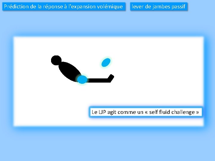 Prédiction de la réponse à l'expansion volémique → lever de jambes passif Le LJP