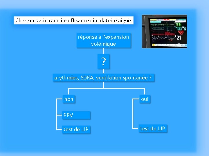 Chez un patient en insuffisance circulatoire aiguë réponse à l'expansion volémique ? arythmies, SDRA,