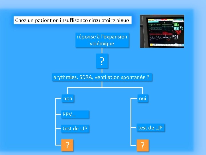 Chez un patient en insuffisance circulatoire aiguë réponse à l'expansion volémique ? arythmies, SDRA,