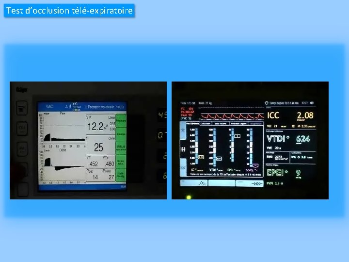 Test d’occlusion télé-expiratoire 