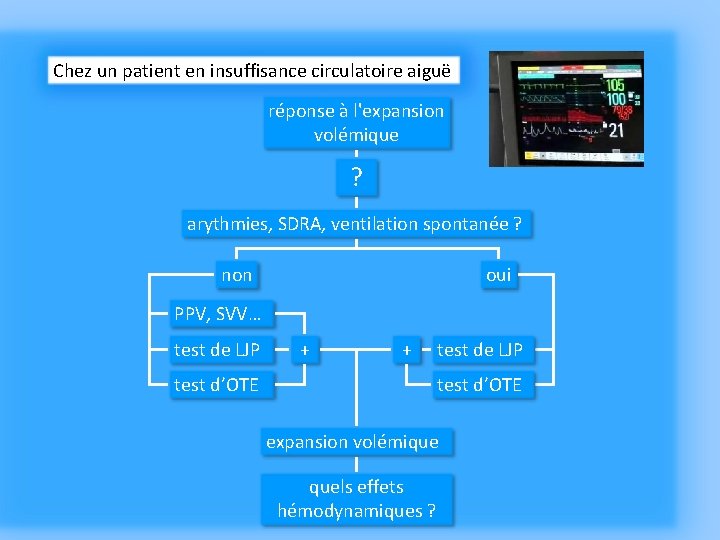 Chez un patient en insuffisance circulatoire aiguë réponse à l'expansion volémique ? arythmies, SDRA,