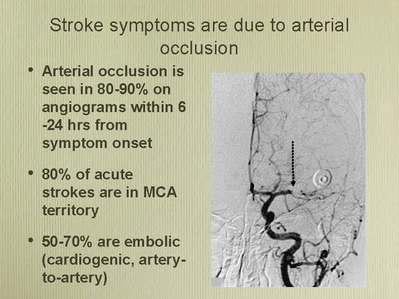 Stroke symptoms are due to arterial occlusion • Arterial occlusion is seen in 80