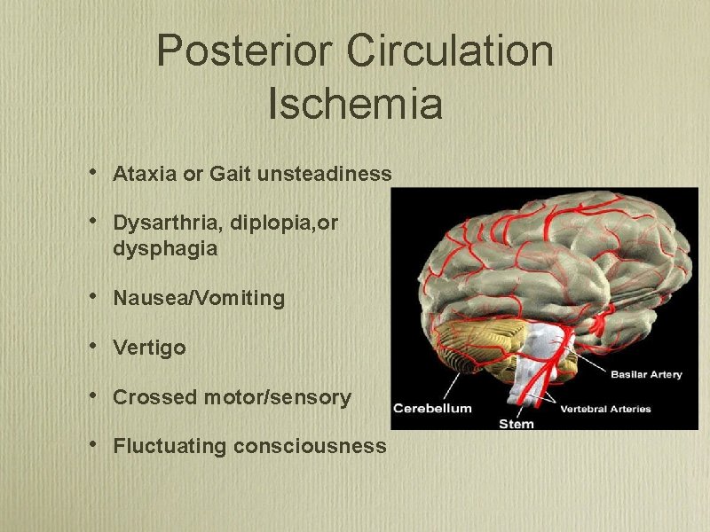Posterior Circulation Ischemia • Ataxia or Gait unsteadiness • Dysarthria, diplopia, or dysphagia •
