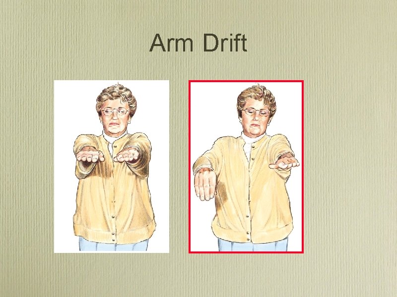 Arm Drift 