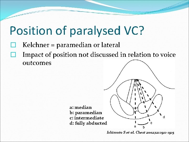 Position of paralysed VC? � Kelchner = paramedian or lateral � Impact of position Position of paralysed VC? � Kelchner = paramedian or lateral � Impact of position