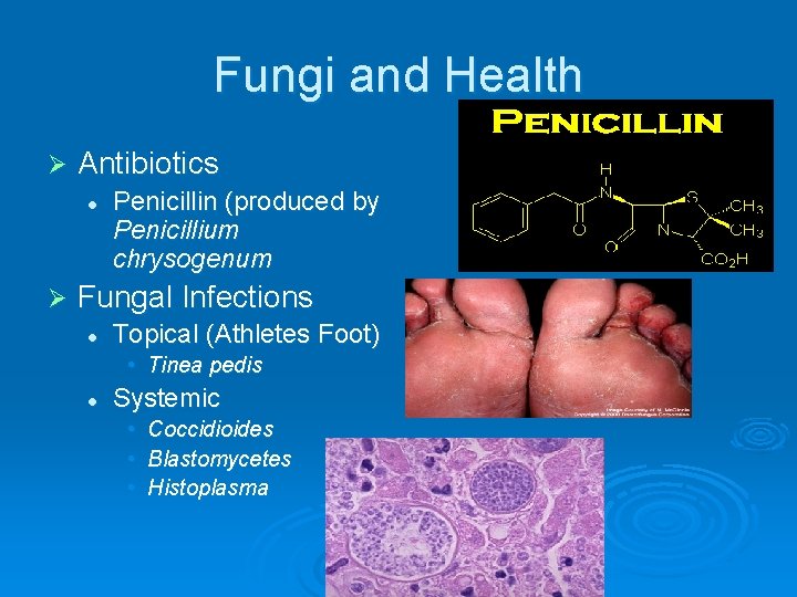 Fungi and Health Ø Antibiotics l Ø Penicillin (produced by Penicillium chrysogenum Fungal Infections
