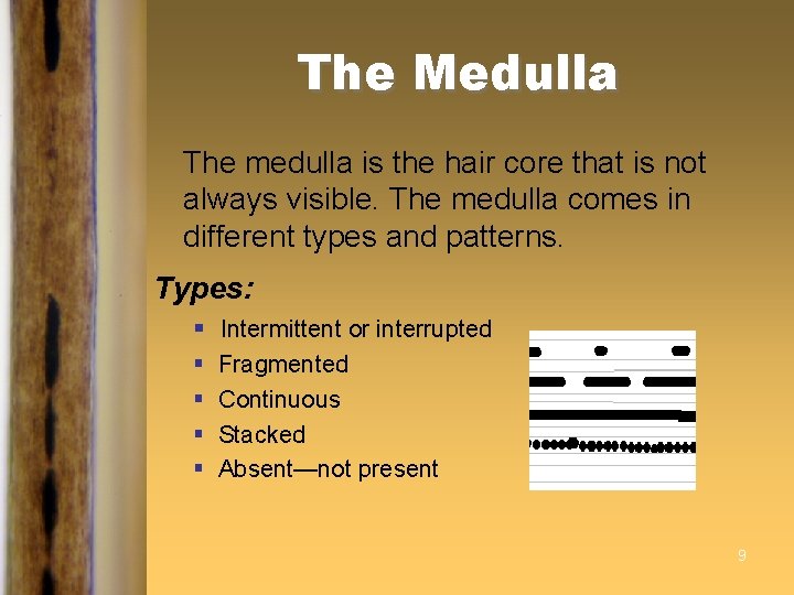 The Medulla The medulla is the hair core that is not always visible. The The Medulla The medulla is the hair core that is not always visible. The