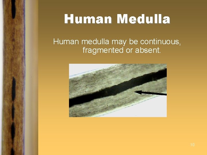 Human Medulla Human medulla may be continuous, fragmented or absent. 10 Human Medulla Human medulla may be continuous, fragmented or absent. 10