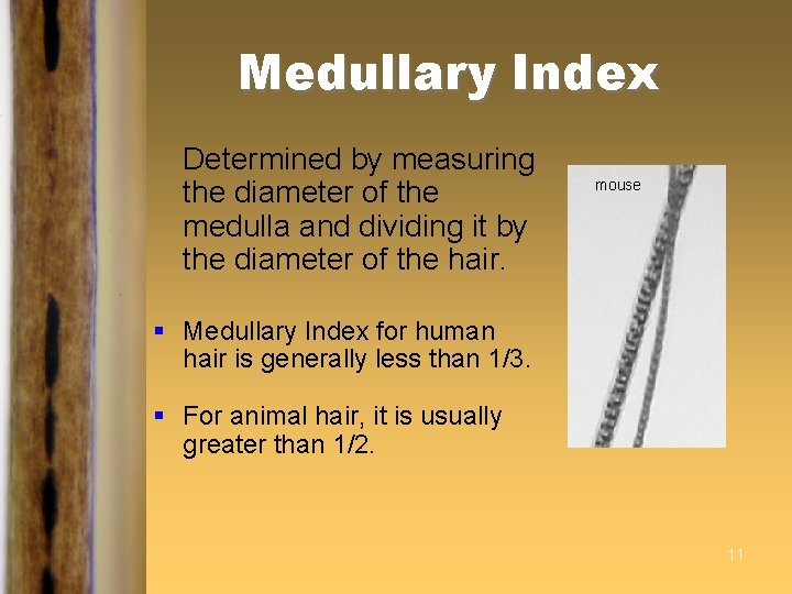 Medullary Index Determined by measuring the diameter of the medulla and dividing it by Medullary Index Determined by measuring the diameter of the medulla and dividing it by
