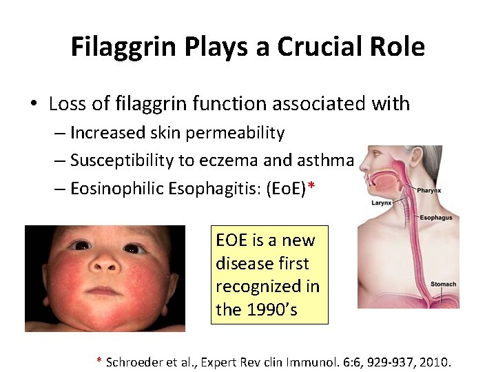 Filaggrin Plays a Crucial Role • Loss of filaggrin function associated with – Increased