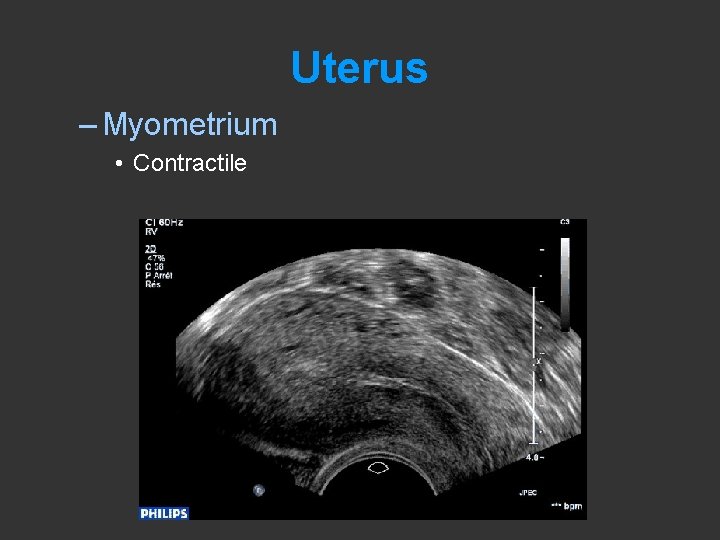 Uterus – Myometrium • Contractile • bjl 